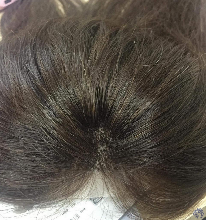 How To Choose Perfect Custom Made Human Hair Toppers [2019 Buying Guide]