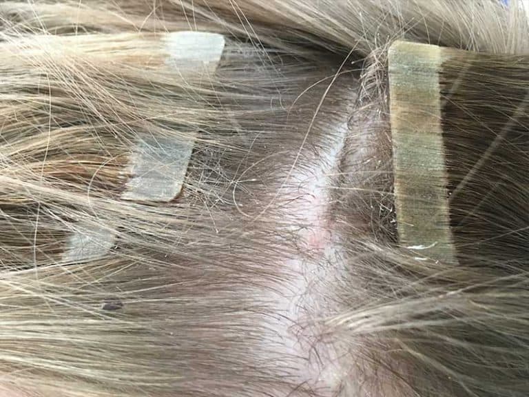 A Startling Fact About Tape Extensions Damage Uncovered! Layla Hair
