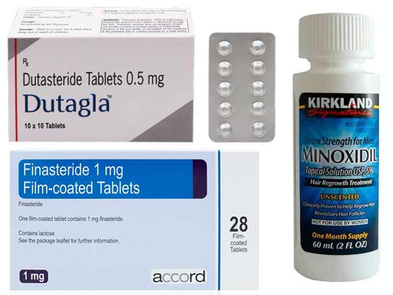does finasteride improve hairline