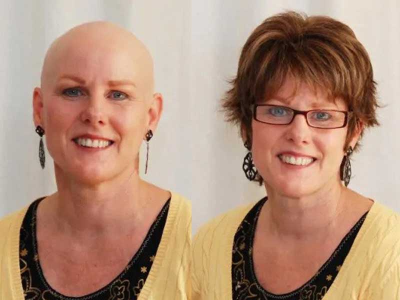 wigs for cancer patients mn