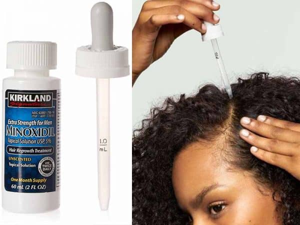 Get The Scoop On Minoxidil For Hair Loss Right Now | Lewigs