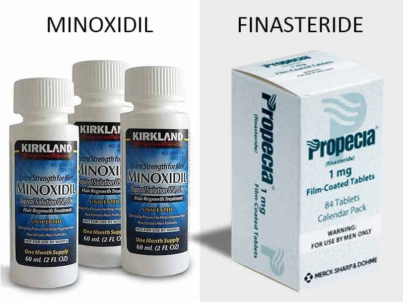 can i use minoxidil without finasteride