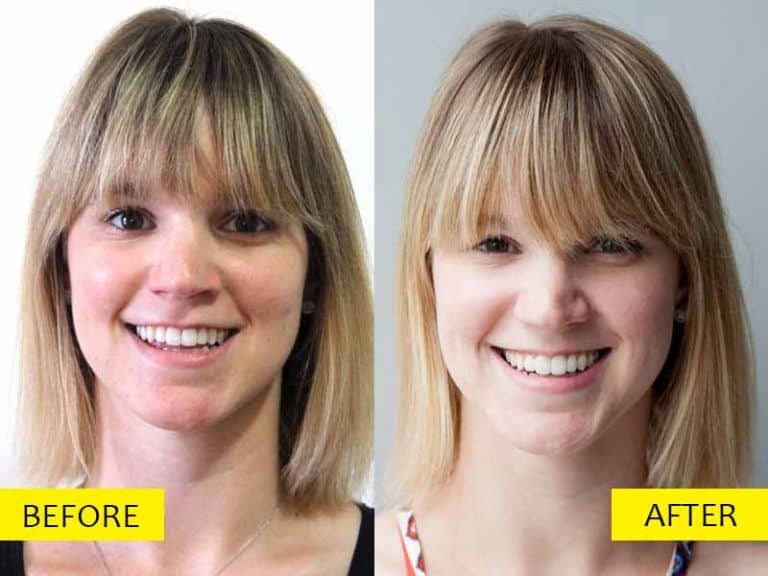 How To Lighten Hair With Lemon Juice? Advice From Experts